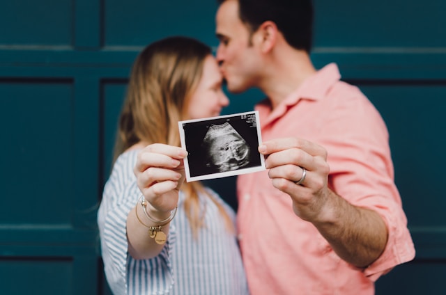 man kissing woman's forehead as they both hold untrasound photo