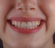 smile with teeth