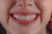 smile with teeth
