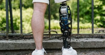 man with prosthetic leg rear view below shorts